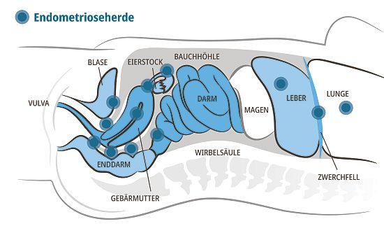 Grafik: Widschwendter