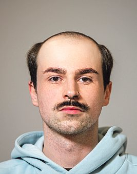 Vorher und nachher: Moderne Haarlösungen...