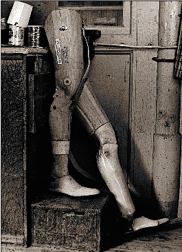 Beinprothese aus den 1950er Jahren. SCHAUB KG