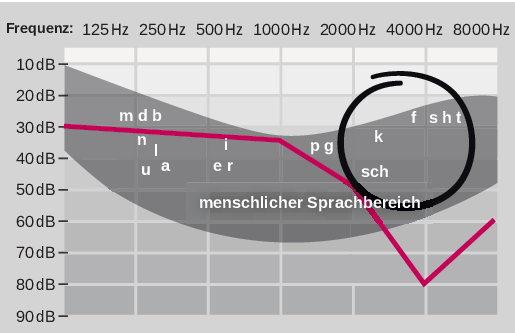 Typischer Hörverlust: Er nimmt zu den hohen Tönen hin zu. Dadurch sind Sprachlaute wie ch, f, s und t schlechter wahrnehmbar. Es klingt, als ob der Gesprächspartner nuschelt.