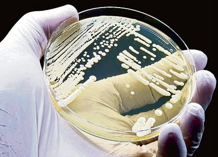 Mikrobiologische Kultur des Hefepilzes Candida auris, der für Harnwegsinfektionen (UTI) verantwortlich ist. Foto: TopMicrobialStock - stock.adobe.com