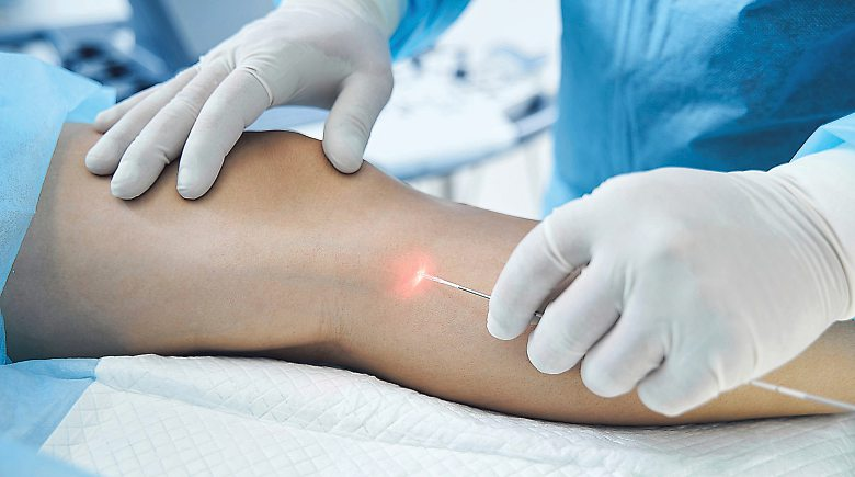 Therapien und Behandlungen mit dem Laser sind schonend für das Gewebe. Foto: Svitlana - stock.adobe.com