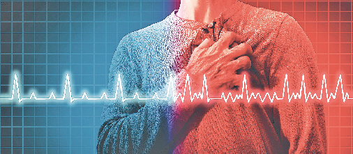 Im Rhythmus bleiben: Herz-Unregelmäßigkeiten sind mehr als eine Taktstörung. FOTO: FRESHIDEA - STOCK.ADOBE.COM
