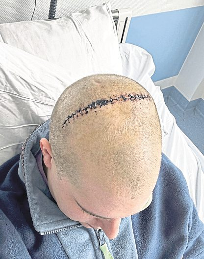 Dennis Dohm war nach seiner ersten Operation im Bundeswehrzentralkrankenhaus in Koblenz optimistisch, dass er den Krebs besiegt hatte. Doch der kam wieder. Foto: Dennis Dohm